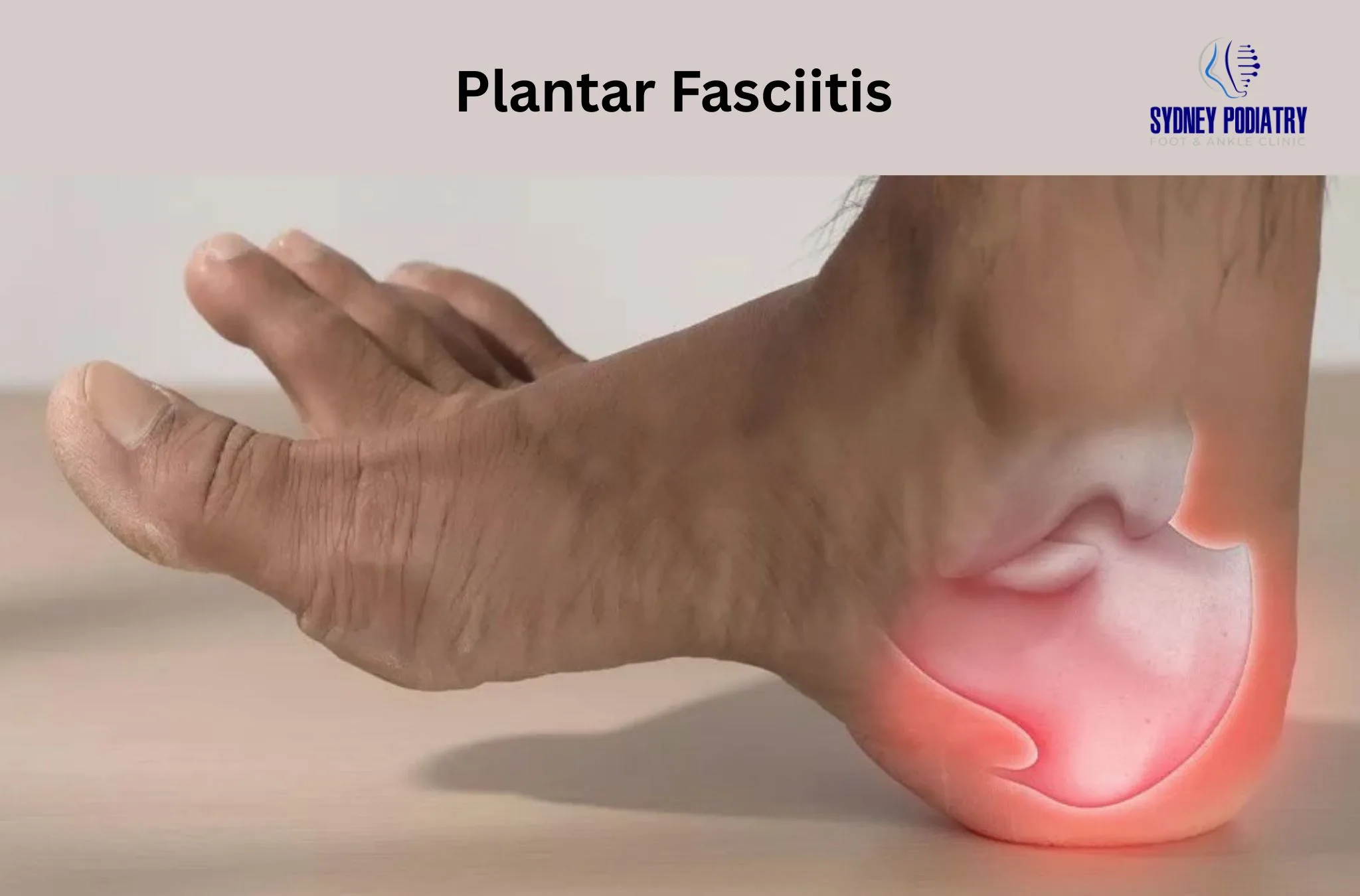 Plantar Fasciitis