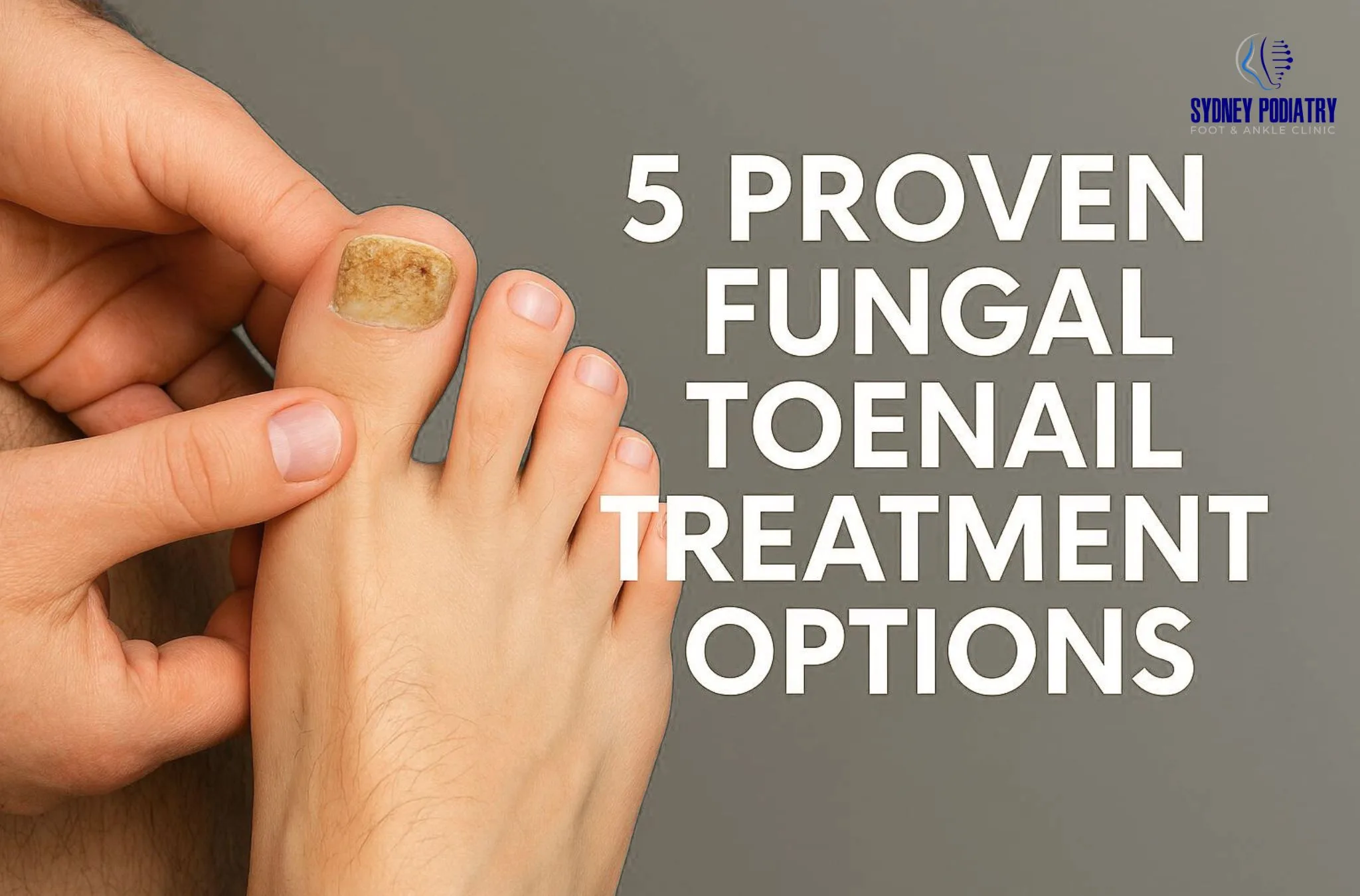 Fungal Toenail Treatment